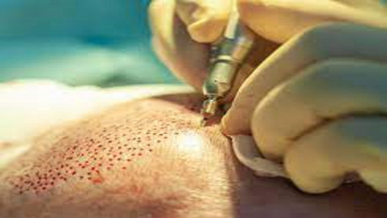 2021 list of the best dermatologists specialist in Gurgaon