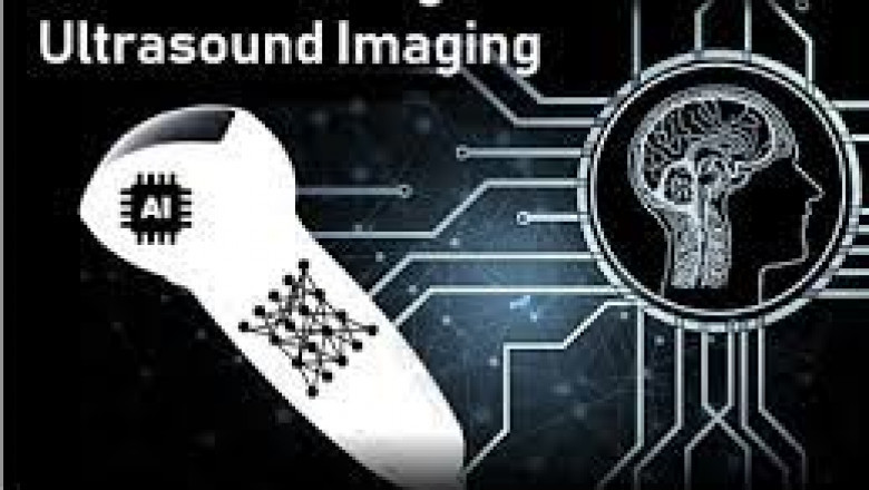 Artificial Intelligence Chipset Market 2022 Size, Growth Factors &amp; Forecast Report to 2028