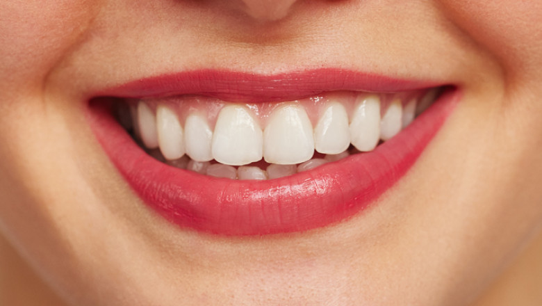 DENTIST IN FARMINGTON CT