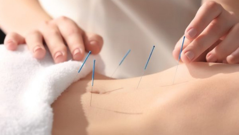 Laser Acupuncture Clinic And Research Centre - 777healthcare