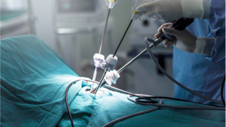 Global Laparoscopic Power Morcellators Market Overview