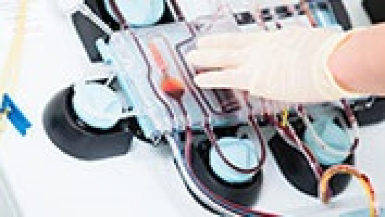 The Future of Continuous Renal Replacement Therapy (CRRT) Market - Overview