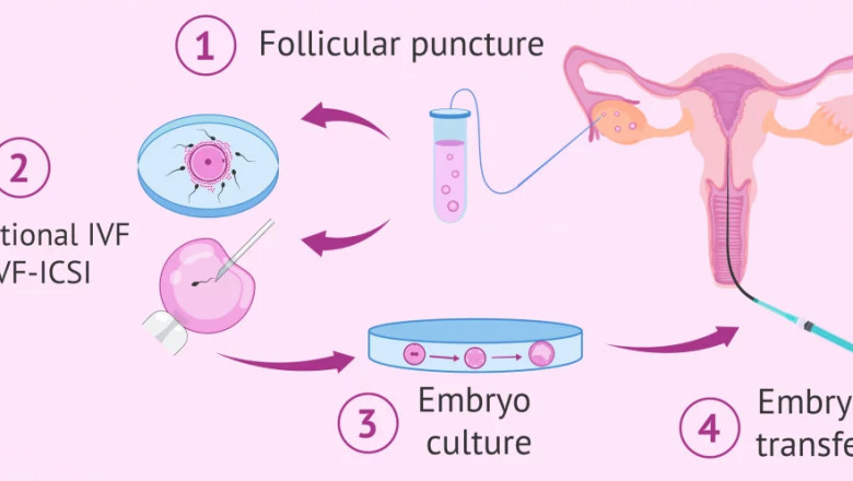 Step By Step Guide to Make Your Treatment Successful For You
