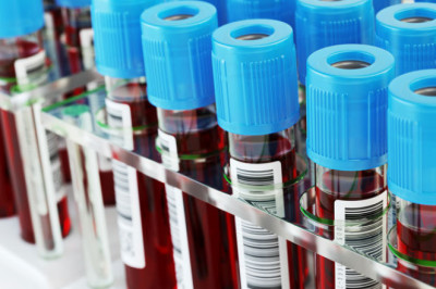 Amylase Testing Market 2022 Key Players, Share & Forecast Report to 2028