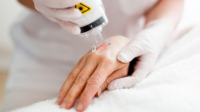 Global Aesthetic Laser Market: Detailed Analysis by Latest Trends, Demand and Forecast to 2028
