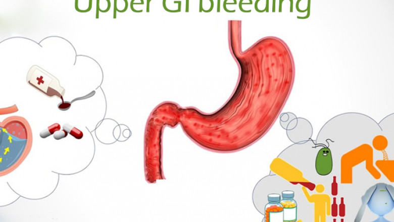 Upper GI Bleed – Blood Vomitus or Black Stools