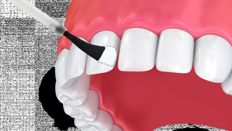 Dental Fluoride Treatment Market Growth By Key Players [Top 10] And Forecast To 2029