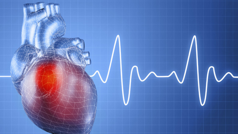 What is Cardiovascular Information System?
