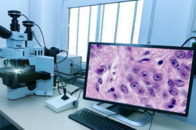 Global Digital Pathology Market Size, Share, Latest Trades and Growth Analysis Report Till 2028