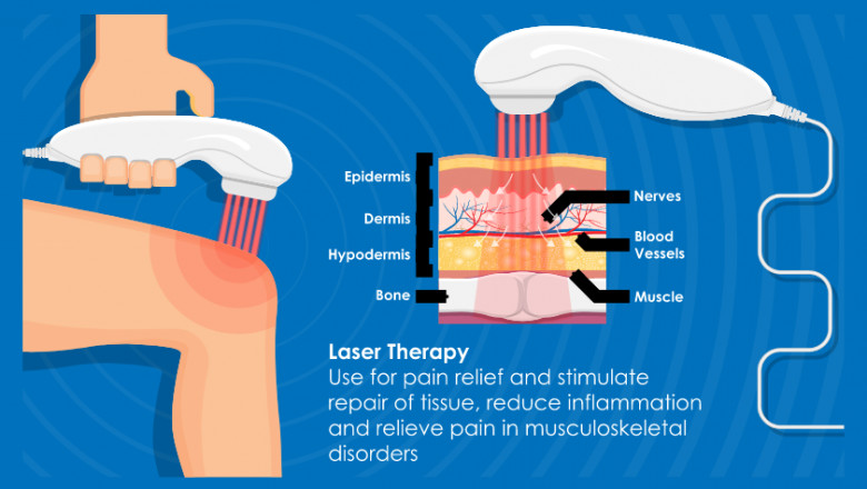 COLD LASER TREATMENT