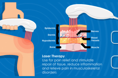 COLD LASER TREATMENT