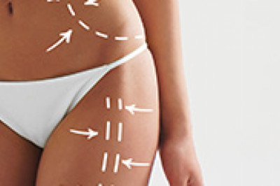 Body Contouring Treatment In Ahmedabad - Non-Surgical Contouring Surgery