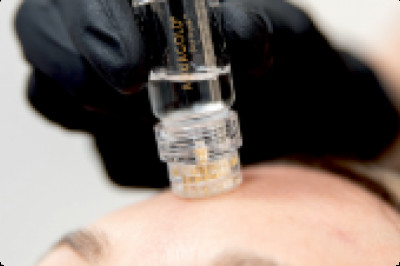 Microgold Infusion Facial Treatment | Medical Facial | Musk Clinic