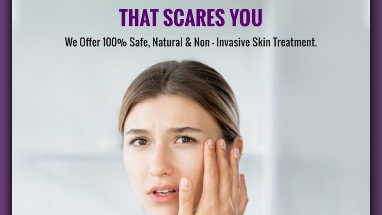 How to find the Best under Eyes Dark Circle Removal Treatment in Bangalore