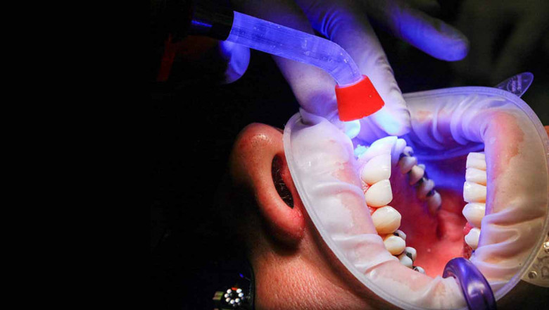 You Should Seek Immediate Dental Care In Case Of An Emergency