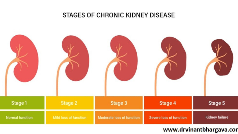 Is Chronic Kidney Failure Curable?