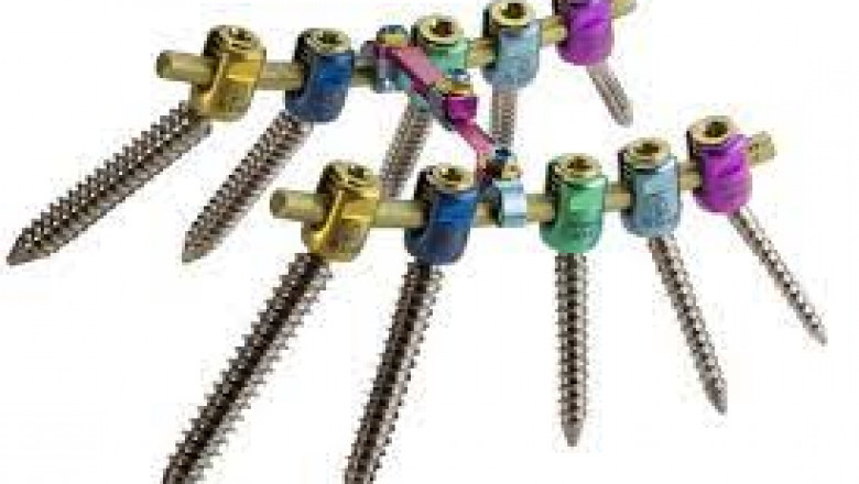 Pedicle Screw Systems Market Size, Status, Growth | Industry Analysis Report 2020-2028