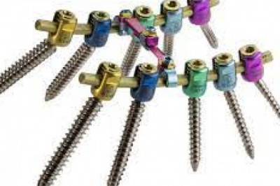 Pedicle Screw Systems Market Size, Status, Growth | Industry Analysis Report 2020-2028