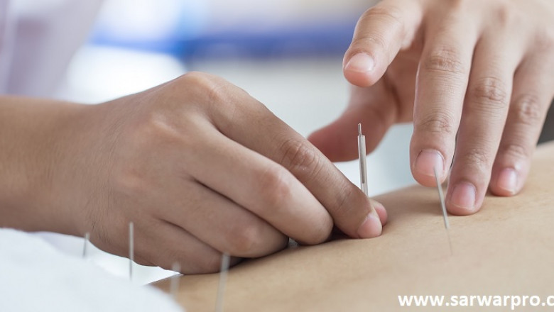 What are trigger points and how are they treated?