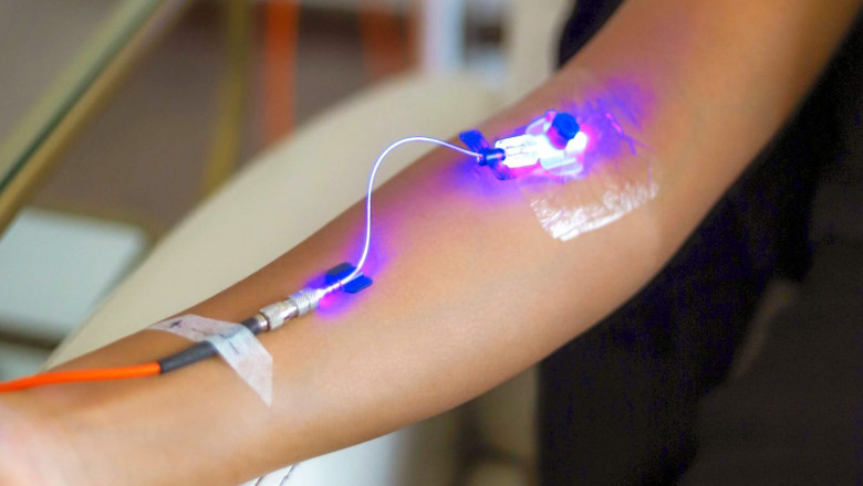 Global Blood Irradiation Market Report, Latest Trends, Industry Opportunity &amp; Forecast to 2028