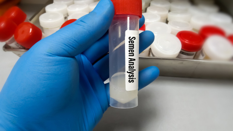 Semen Analysis Market Growth Opportunity and Analysis