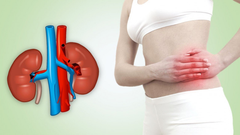 Solid Masses - Unani Medicine For Painful Kidney Stones ?