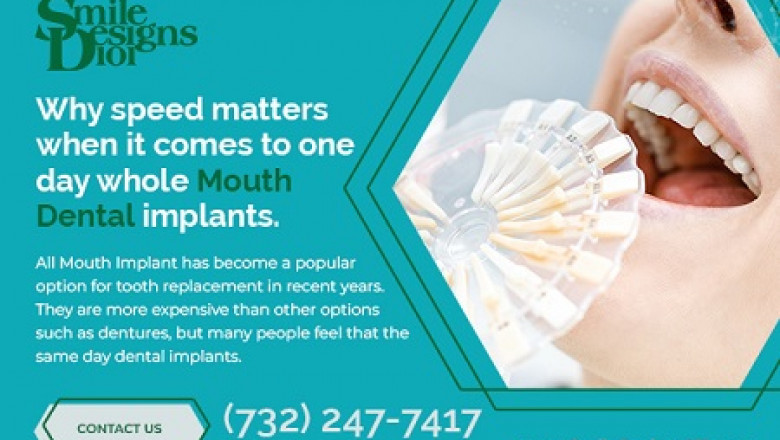 Why speed matters when it comes to one day whole mouth dental implants