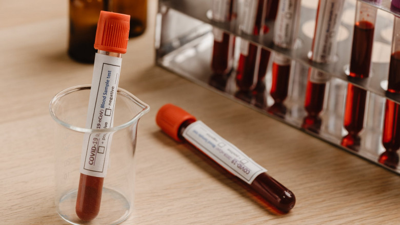 A blood collection tube is used for collecting samples to diagnose diseases related to blood