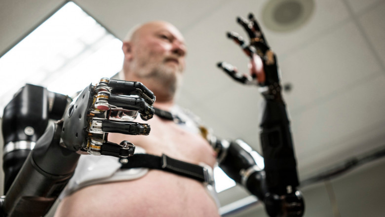 Global Medical Bionic Implants Market players