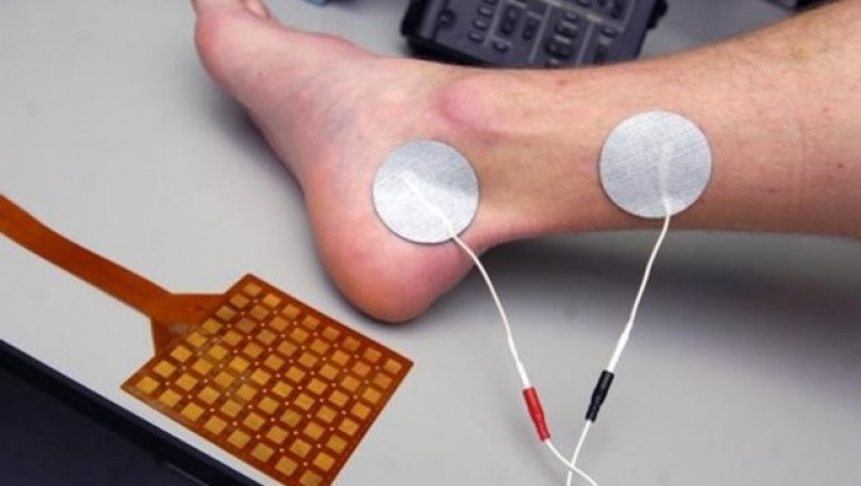 Global Overactive Bladder Therapeutics Market regional Analysis