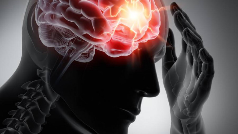 Head Injury Treatment in Sangamner – Dr. Prasad Umbarkar