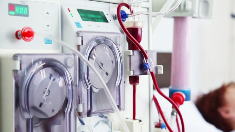 Kidney Dialysis Equipment Is Used When A Person’s Kidneys Are Impaired Beyond Any Feasible Treatment