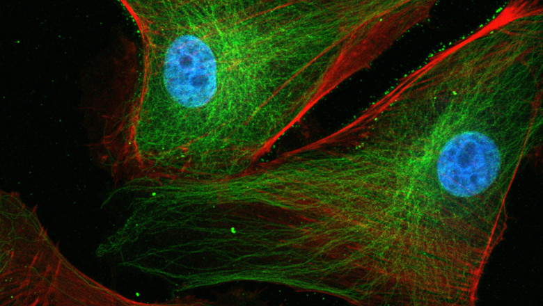 Neuro Microscopy Market Insights 2022, Global Analysis and Forecast to 2030