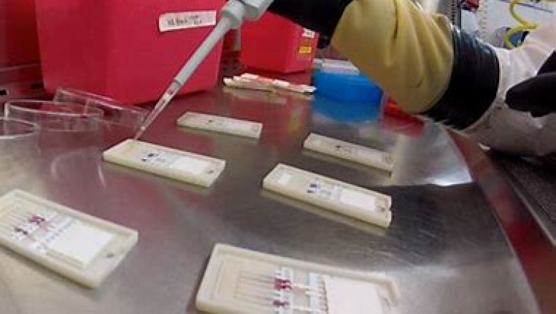 Paper Diagnostics Market 2022 | Top Key Players Analysis Report Till 2028