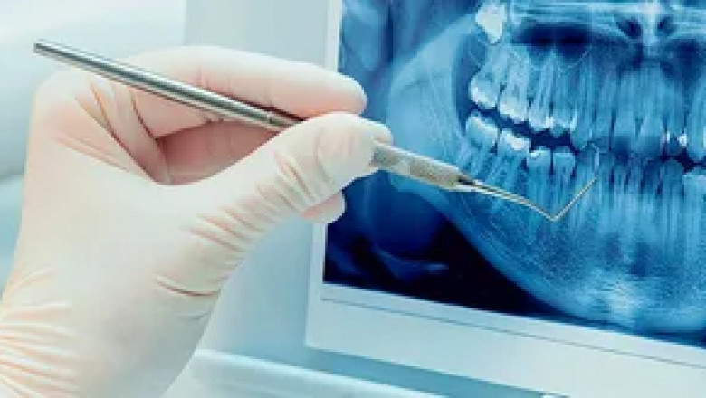Dental Imaging Market Demand, And Recent Trends 2022-2029