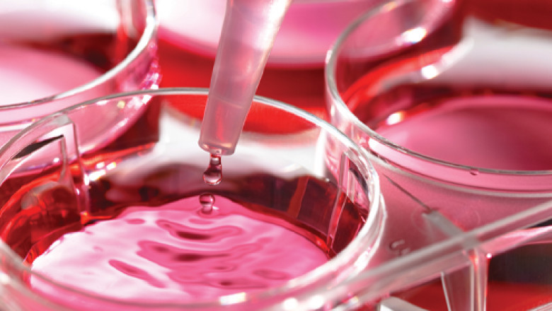 Media Sera and Reagents Market Global Industry Trends, Share, Size, Growth, Opportunity, Forecast