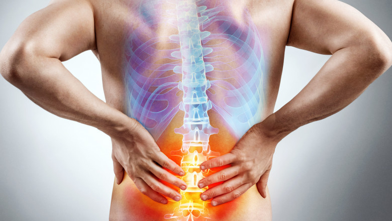 Sciatica Occurs Commonly As A Result Of A Herniated Lumbar Disc Pressing Directly On The Nerve