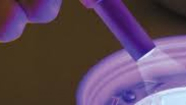 UV Cured Resins Market Size, Status, Growth | Industry Analysis Report 2020-2028