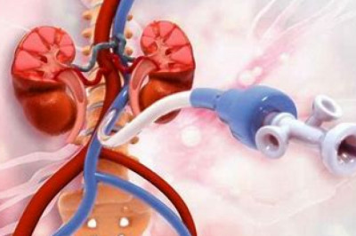 Peripheral Artery Revascularisation Market 2022 | Top Key Players Analysis Report Till 2028