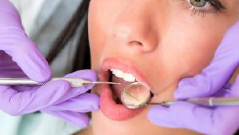 What Are the Benefits, and Side Effects, of Fluoride Treatment?