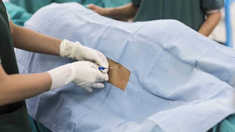 Brief about Epidural Anesthesia Disposable Devices