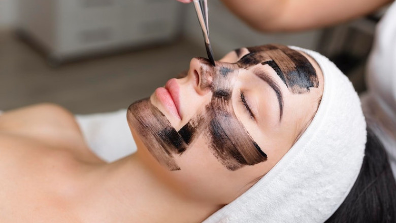 Carbon Peeling In Delhi - Ayushmanscs