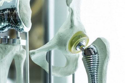 Orthopedic Biomaterials Market: Size Analysis By Growth, CAGR of ~9%, and Forecast To 2030