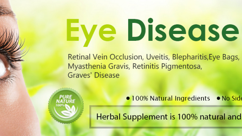 7 Most Important Herbal Supplement for Eye Diseases Prevention