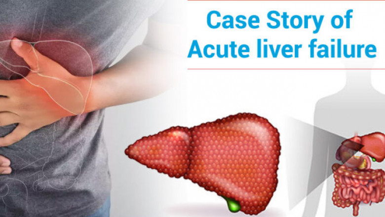 Acute liver failure - Dr. Pathik Parikh