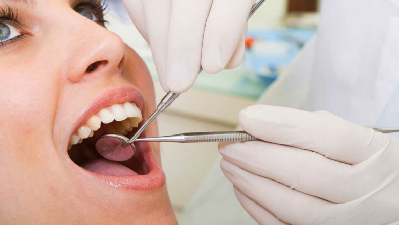 When Should You Have Wisdom Teeth Removal?