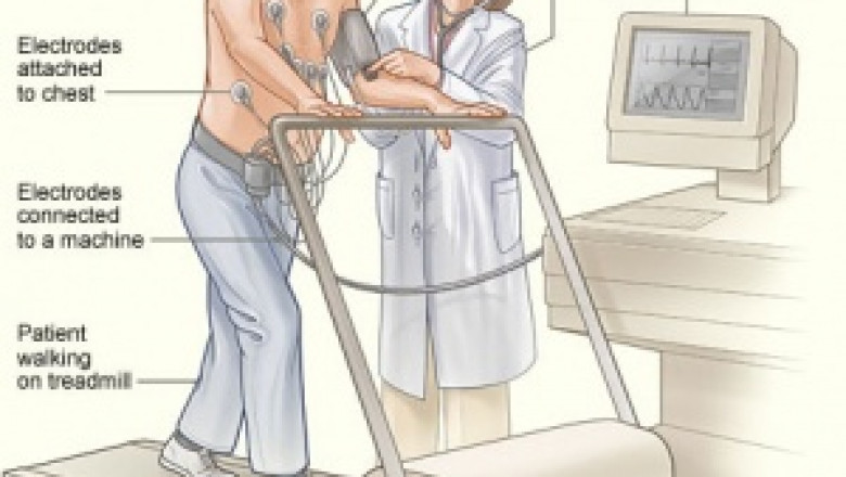Cardiac Rehabilitation Devices Market Size growing at 7% CAGR to hit USD 237 million by 2027