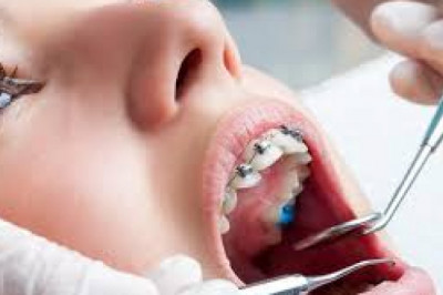 Why You Need Orthodontics for Your Child – The Best Orthodontist in Brooklyn