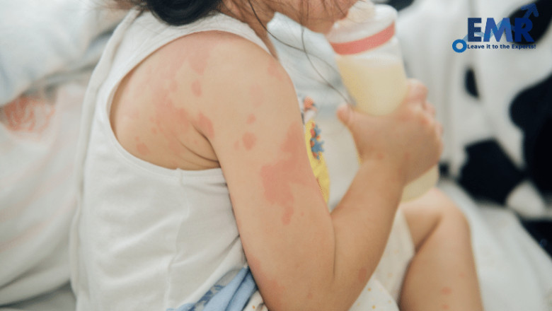 ABSSSI Treatment Market Size, Share, Price, Trends, Growth, Analysis, Outlook, Report, Forecast 2021-2026