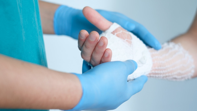 Best Hand Surgeon in San Antonio, TX